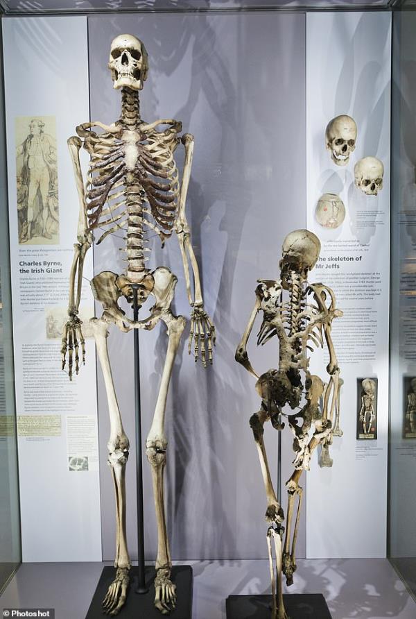 Charles Byrne did everything he could while he existed to ensure that his skeleton was not displayed after his death - a fate usually reserved for executed criminals